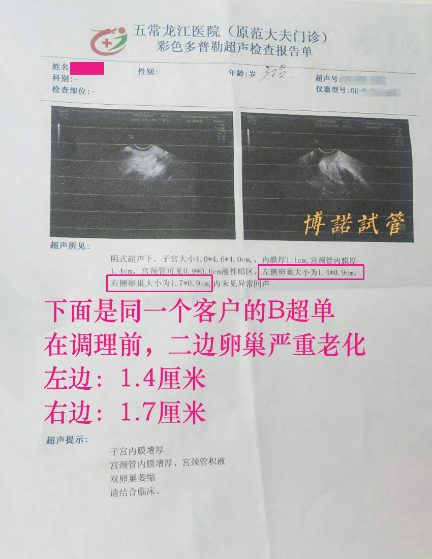 澳洲借卵成功率.jpg