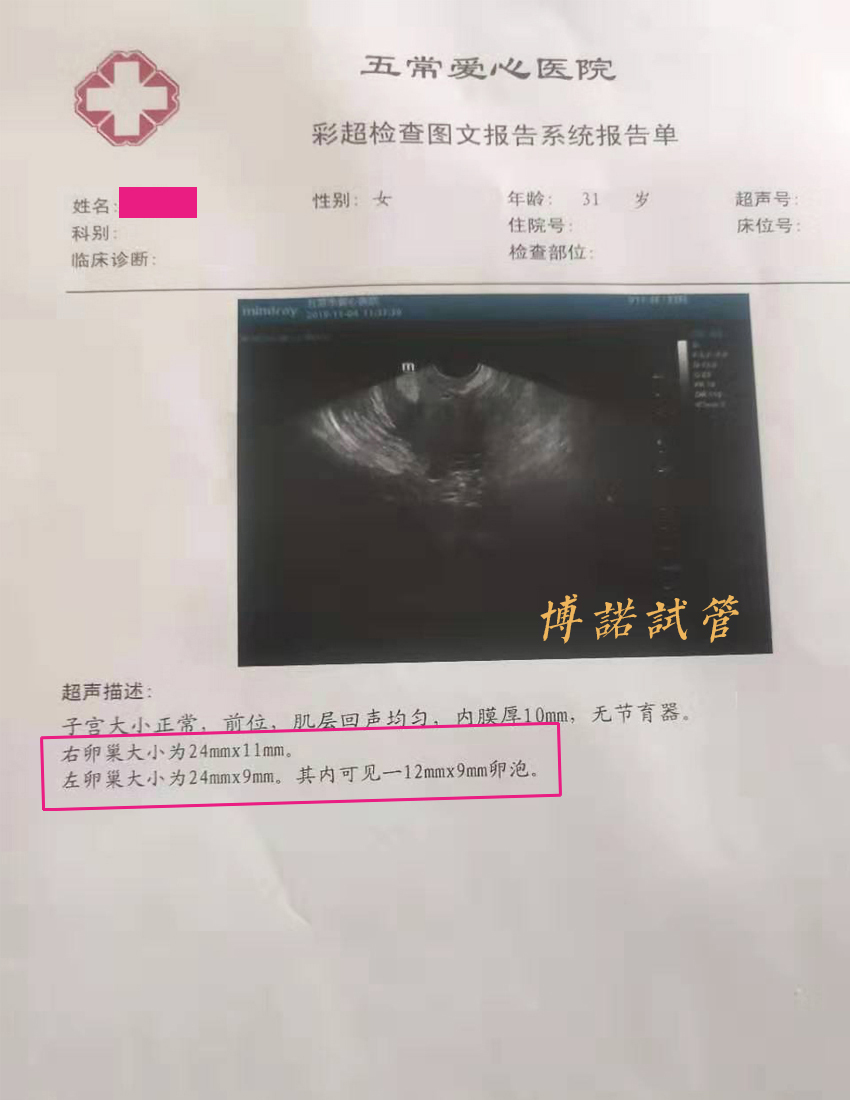 澳洲借卵费用.jpg