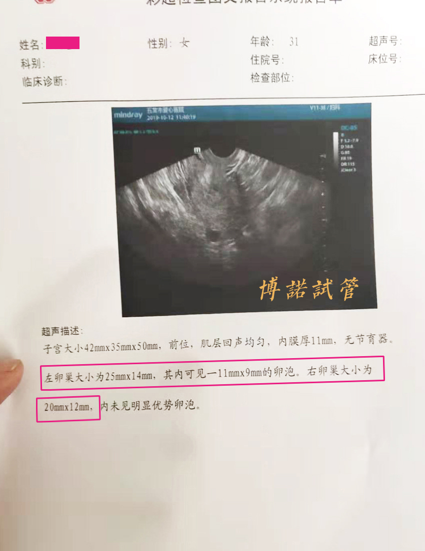 澳洲借卵试管医院.jpg