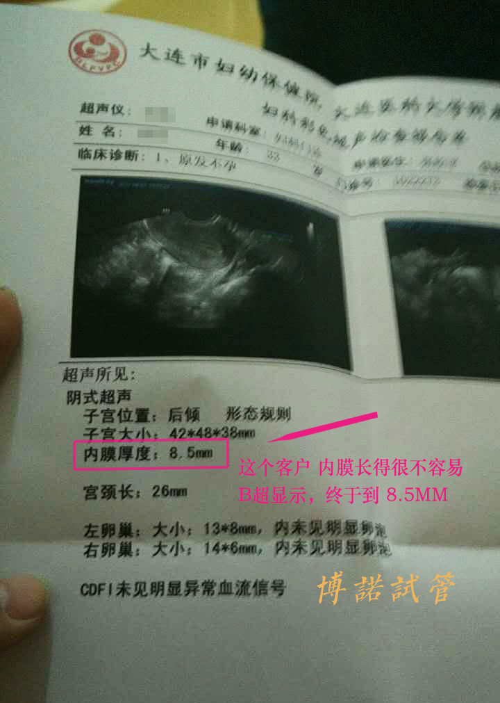 澳洲借卵试管婴儿.jpg